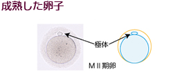 培養室から成熟した卵子
