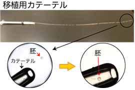 培養室から移植用カテーテル