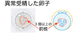 培養室から異常受精した卵子