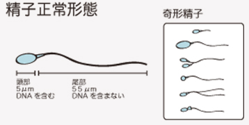 培養室から精子正常形態