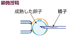 培養室から顕微授精