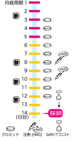 体外受精・クロミフェンスケジュール