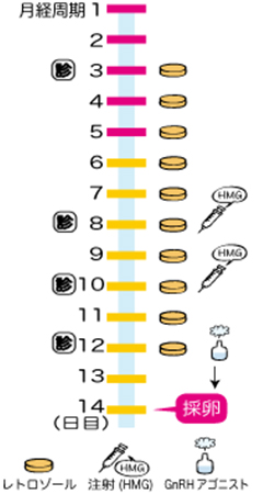 体外受精・レトロゾールスケジュール