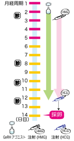 体外受精・ショート法スケジュール