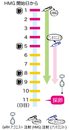 体外受精・ランダムスタート法スケジュール