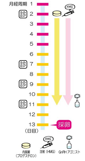 体外受精・PPOSスケジュール