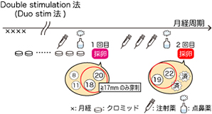 卵巣機能低下Double stimulation法(Duo stim法)