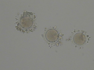 卵子凍結保存顆粒膜細胞が少し残った卵子