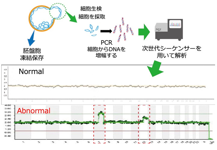 PGT-A(着床前胚染色体異数性検査)写真