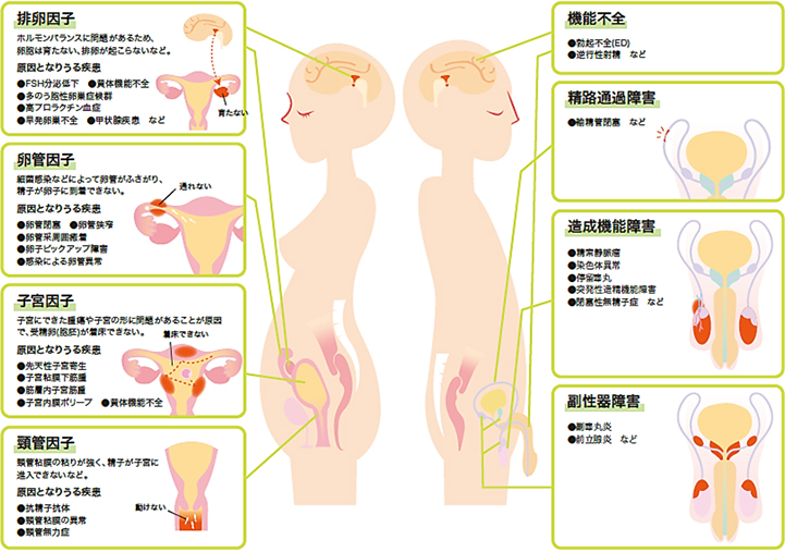 不妊の原因・検査不妊症の男性・女性の原因と種類